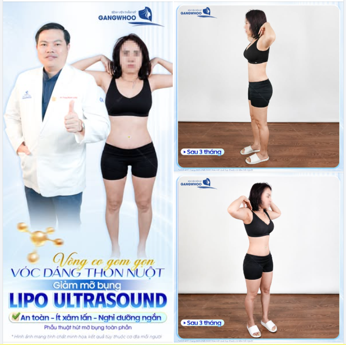 VÒNG EO THON GỌN - VÓC DÁNG THON NUỘT