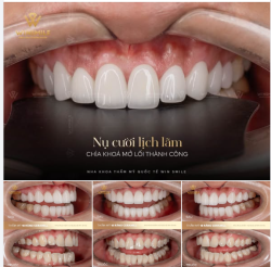 Điểm nhấn làm nên thần thái của người đàn ông thành đạt chính là sự tự tin trong từng khoảnh khắc giao tiếp, và nụ cười chính là điểm bắt đầu cho mọi kết nối bền vững