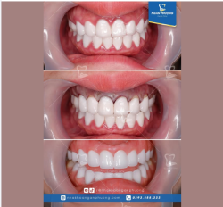 Sức khỏe răng miệng luôn cần ưu tiên hàng đầu