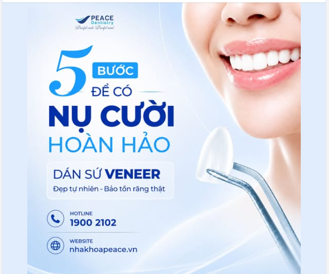 5 BƯỚC SỞ HỮU NỤ CƯỜI "VẠN NGƯỜI MÊ" VỚI DÁN SỨ VENEER
