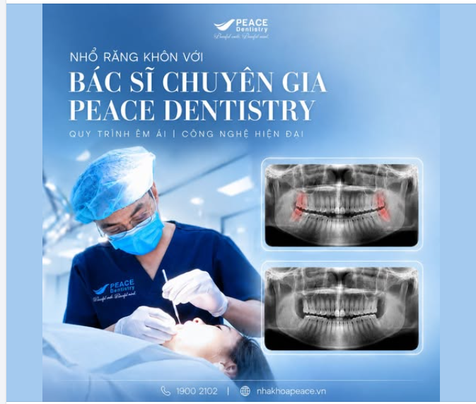NHỔ RĂNG KHÔN CÙNG BÁC SĨ CHUYÊN GIA: TẠI SAO QUY TRÌNH TẠI PEACE DENTISTRY LẠI KHÁC BIỆT?