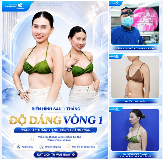 BIẾN HÌNH SAU 1 THÁNG ĐỘ DÁNG VÒNG 1 - NHAN SẮC THĂNG HẠNG, POSE DÁNG TỰ TIN
