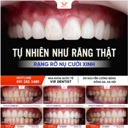 RĂNG SỨ TỰ NHIÊN – ĐẸP NHẸ NHÀNG, KHÔNG LO "GIẢ TẠO"