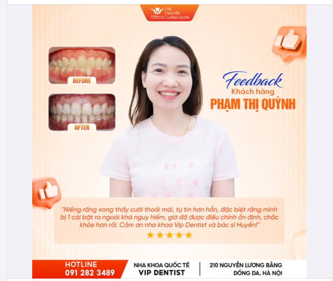 NIỀNG XINH - RĂNG KHỎE - CƯỜI TỰ TIN!
