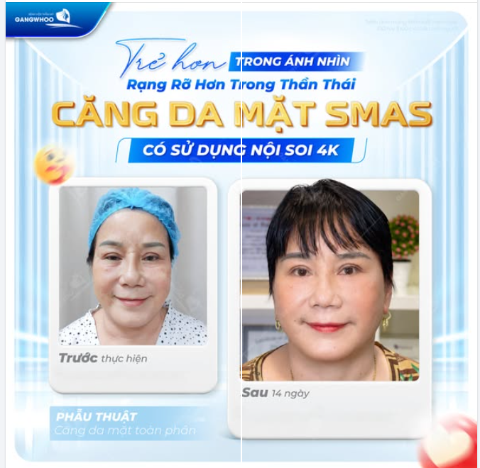 TRẺ HƠN TRONG ÁNH NHÌN – RẠNG RỠ HƠN TRONG THẦN THÁI