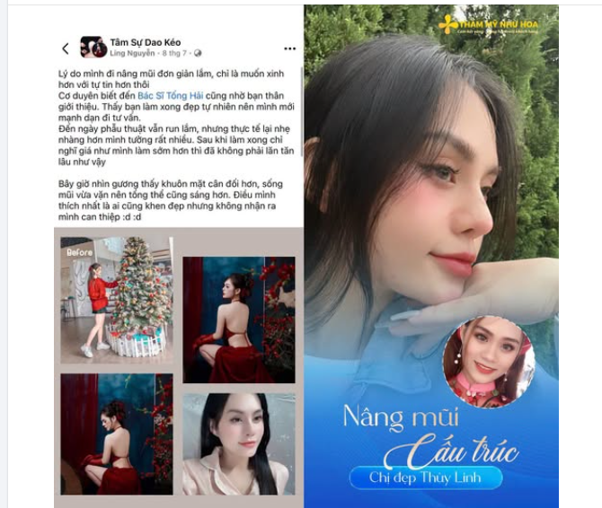 Điều khiến Như Hoa vui nhất là khi khách hàng chia sẻ: “Bạn bè khen đẹp nhưng không nhận ra mình can thiệp.”