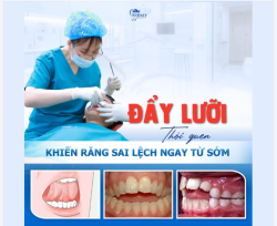 ĐẨY LƯỠI: THÓI QUEN KHIẾN RĂNG SAI LỆCH NGAY TỪ SỚM