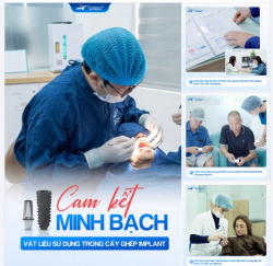 NHA KHOA LẠC VIỆT INTECH CAM KẾT MINH BẠCH VẬT LIỆU IMPLANT