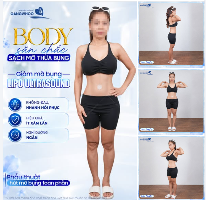 BODY SĂN CHẮC CẢI THIỆN VÓC DÁNG