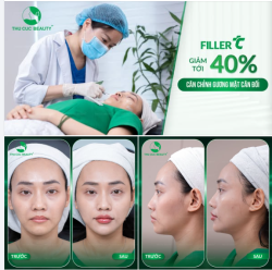 CƠ HỘI VÀNG: FILLER TC GIẢM TỚI 40% – CÂN CHỈNH GƯƠNG MẶT CÂN ĐỐI, TỰ NHIÊN!