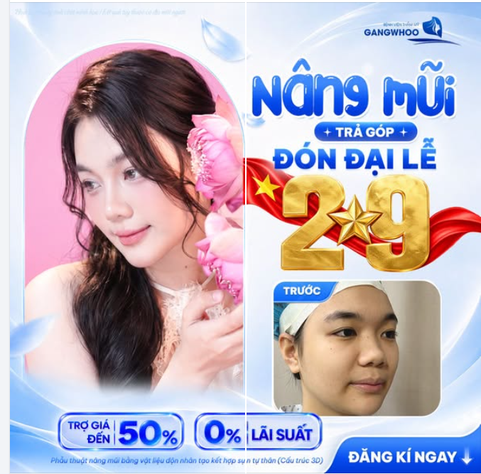 NÂNG MŨI TRẢ GÓP LÃI SUẤT 0% - ĐÓN ĐẠI LỄ 2/9