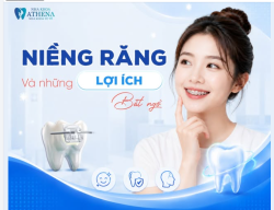 NIỀNG RĂNG VÀ NHỮNG LỢI ÍCH BẤT NGỜ BẠN CÓ THỂ CHƯA BIẾT!