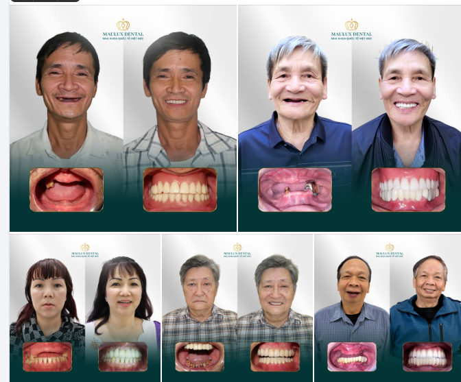 NỤ CƯỜI CHO CHA MẸ - BÁO HIẾU ĐỪNG CHỈ NÓI BẰNG LỜI