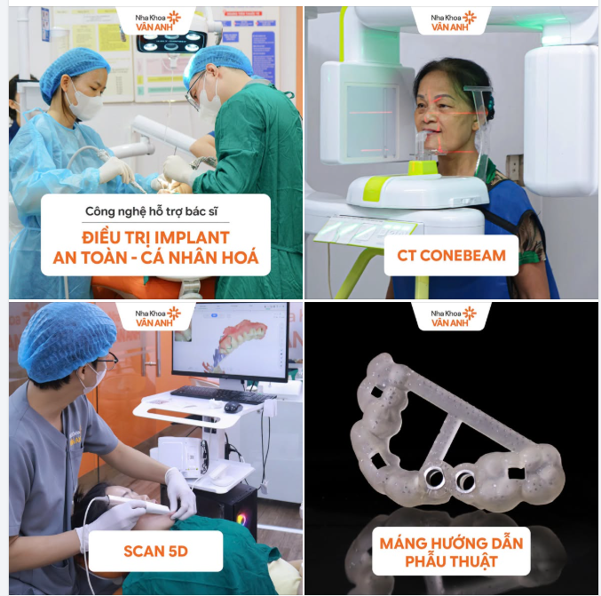 MỖI NỤ CƯỜI LÀ MỘT BẢN THỂ DUY NHẤT - XU HƯỚNG CÁ NHÂN HÓA TRONG NHA KHOA HIỆN ĐẠI