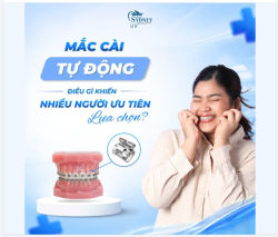 MẮC CÀI TỰ ĐỘNG - ĐIỀU GÌ KHIẾN NHIỀU NGƯỜI ƯU TIÊN LỰA CHỌN?