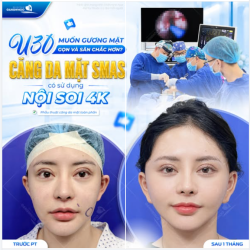 U30 MUỐN GƯƠNG MẶT GỌN VÀ SĂN CHẮC HƠN?