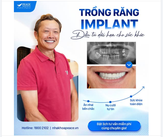 TẠI SAO IMPLANT LÀ KHOẢN ĐẦU TƯ GIÁ TRỊ?