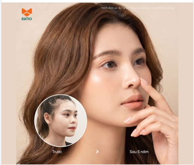 Có những chiếc mũi chỉ đẹp ở thời điểm mới làm.