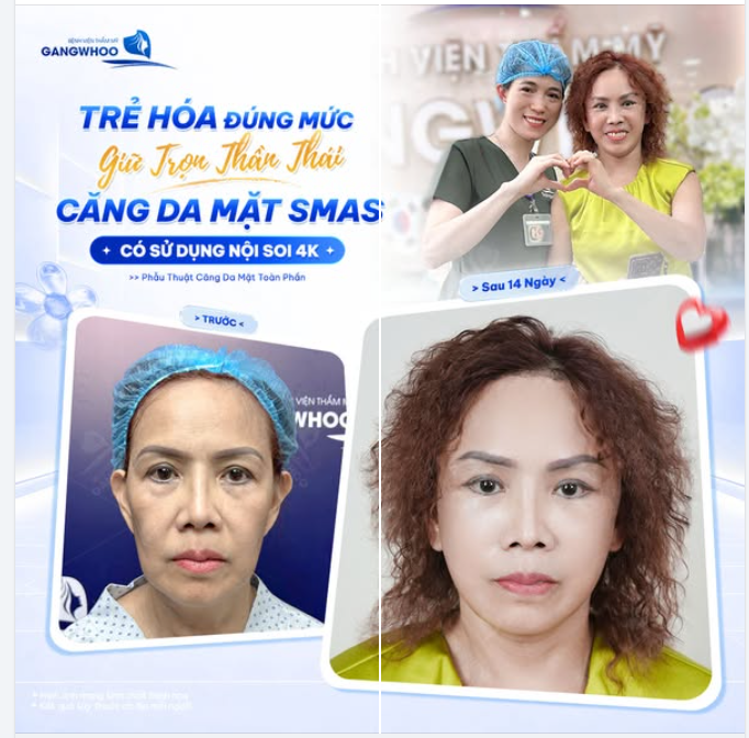 TRẺ HÓA ĐÚNG MỨC – GIỮ TRỌN THẦN THÁI