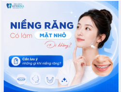 NIỀNG RĂNG CÓ LÀM MẶT NHỎ ĐI KHÔNG?