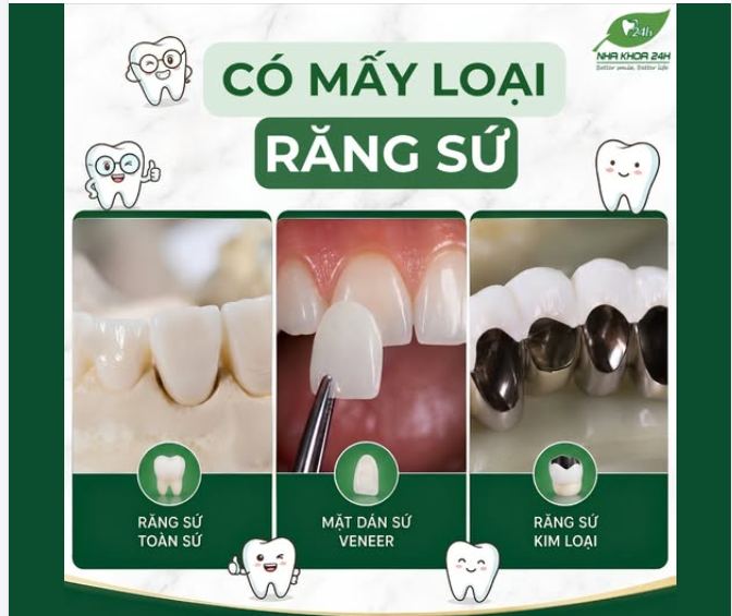 NÊN CHỌN RĂNG SỨ NÀO ĐỂ TỐI ƯU THẨM MỸ VÀ CHI PHÍ?