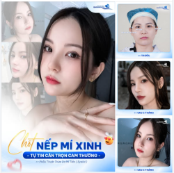 CHỐT NẾP MÍ XINH - TỰ TIN CÂN TRỌN CAM THƯỜNG