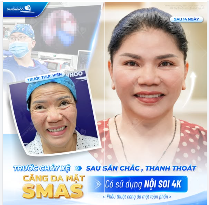 TRƯỚC CHẢY XỆ – SAU SĂN CHẮC, THANH THOÁT