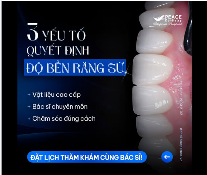 RĂNG SỨ THẨM MỸ: ĐẸP TỰ NHIÊN, BỀN BỈ CÙNG THỜI GIAN