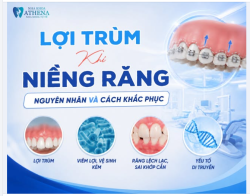 LỢI TRÙM KHI NIỀNG RĂNG: NGUYÊN NHÂN VÀ CÁCH KHẮC PHỤC HIỆU QUẢ