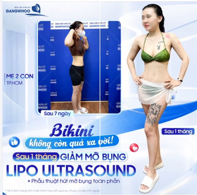 BIKINI KHÔNG CÒN QUÁ XA VỜI!