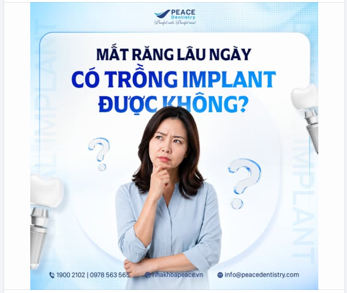 KHÔI PHỤC NỤ CƯỜI, TÁI TẠO SỨC KHỎE SAU NHIỀU NĂM MẤT RĂNG