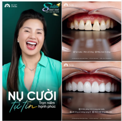 KHI NỤ CƯỜI ĐƯỢC CHĂM SÓC BẰNG CẢ TRÁI TIM