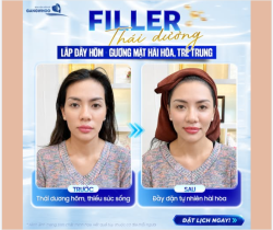 THÁI DƯƠNG HÕM – GƯƠNG MẶT TRÔNG “GIÀ” HƠN TUỔI? ĐÔI KHI CHỈ CẦN LẤP ĐẦY ĐÚNG CHỖ!