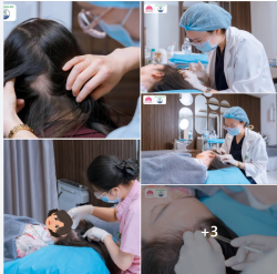 ĐIỀU TRỊ RỤNG TÓC CHUẨN Y KHOA TẠI THẨM MỸ BỆNH VIỆN HỒNG NGỌC