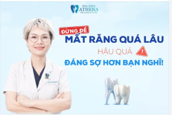 ĐỪNG ĐỂ MẤT RĂNG QUÁ LÂU: HẬU QUẢ ĐÁNG SỢ HƠN BẠN NGHĨ!