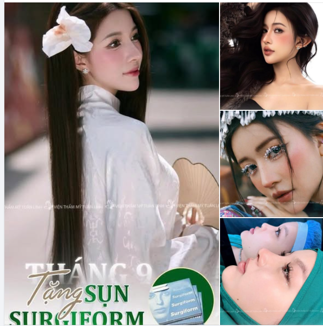 Chị em nào đi làm mũi cấu trúc rồi nhưng chưa ưng dáng?