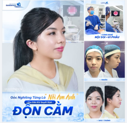 GÓC NGHIÊNG TỪNG LÀ "NỖI ÁM ẢNH"
