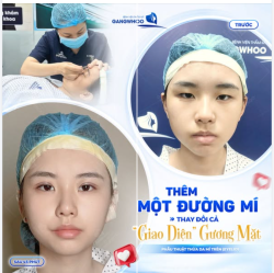 THÊM MỘT ĐƯỜNG MÍ MỚI