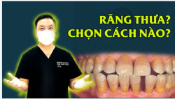 4 PHƯƠNG PHÁP ĐIỀU TRỊ RĂNG THƯA HIỆU QUẢ