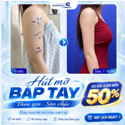 THON GỌN BẮP TAY NHẸ NHÀNG