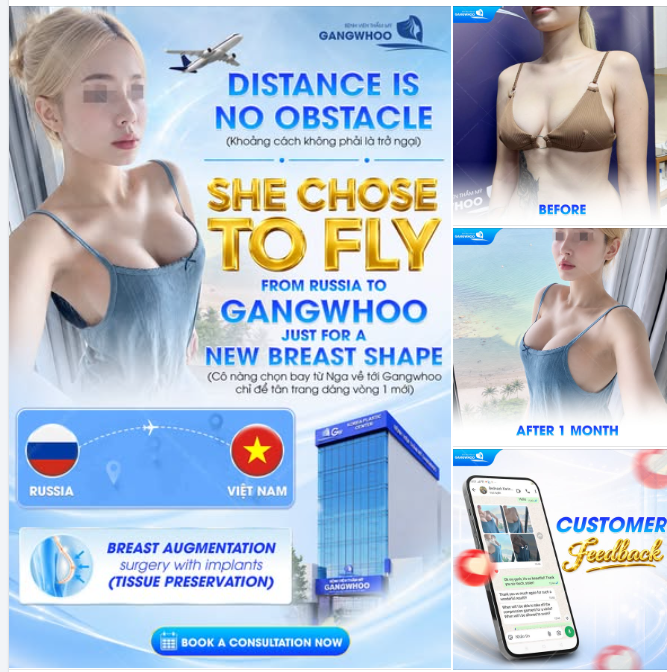KHOẢNG CÁCH KHÔNG PHẢI LÀ TRỞ NGẠI – CÔ NÀNG CHỌN BAY TỪ NGA VỀ TỚI GANGWHOO CHỈ ĐỂ TÂN TRANG DÁNG VÒNG 1 MỚI