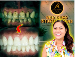 Biết thế Tôi Đã