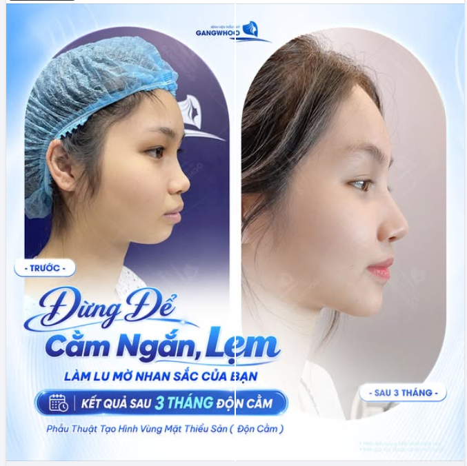 ĐỪNG ĐỂ CẰM NGẮN, LẸM LÀM LU MỜ NHAN SẮC CỦA BẠN