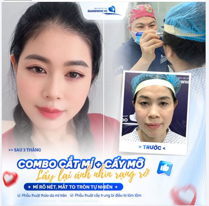 COMBO CẮT MÍ + CÂY MỠ