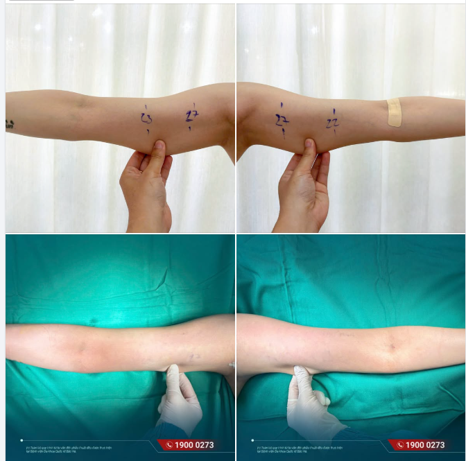 VỪA THỰC HIỆN XONG — ĐƯỜNG NÉT CÁNH TAY ĐÃ ĐƯỢC TINH CHỈNH