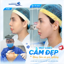 MỘT CHIẾC CẰM ĐẸP - NÂNG TẦM CẢ GÓC NGHIÊNG