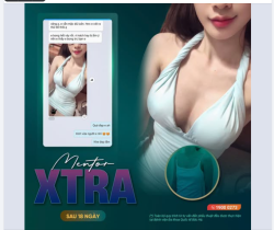 FEEDBACK THẬT – CẢM NHẬN THẬT SAU NÂNG NGỰC MENTOR XTRA