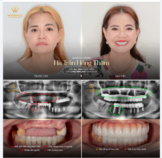 1 ĐỊA ĐIỂM - 2 NĂM ĐỒNG HÀNH
