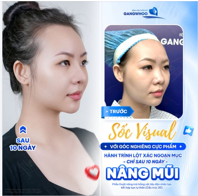 SỐC VISUAL VỚI GÓC NGHIÊNG CỰC PHẨM