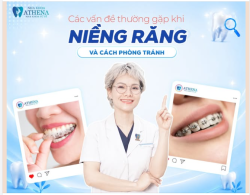 CÁC VẤN ĐỀ THƯỜNG GẶP KHI NIỀNG RĂNG VÀ CÁCH PHÒNG TRÁNH CHUẨN Y KHOA